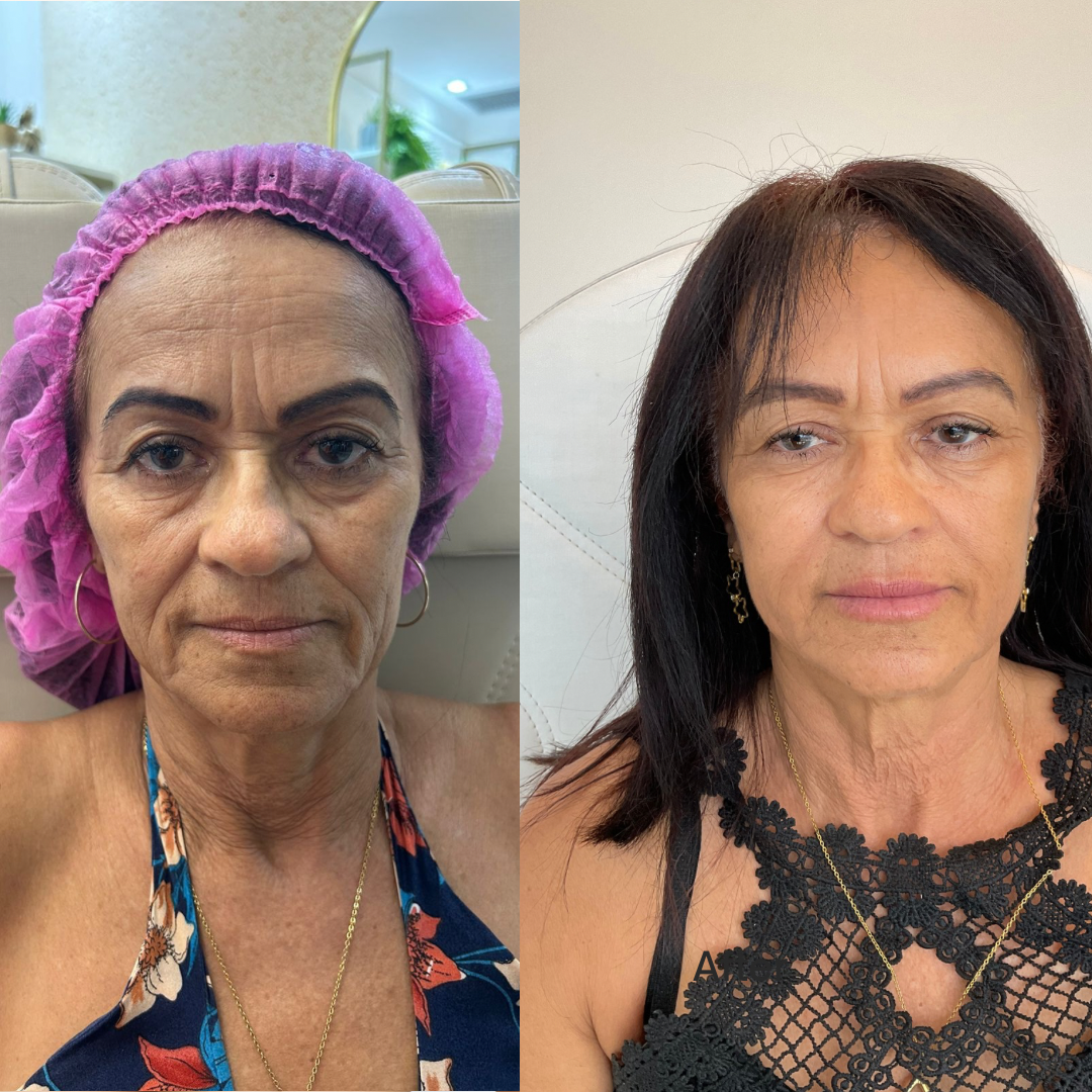 Beige-Minimalist-Skincare-Before-and-After-Instagram-Post-1.png